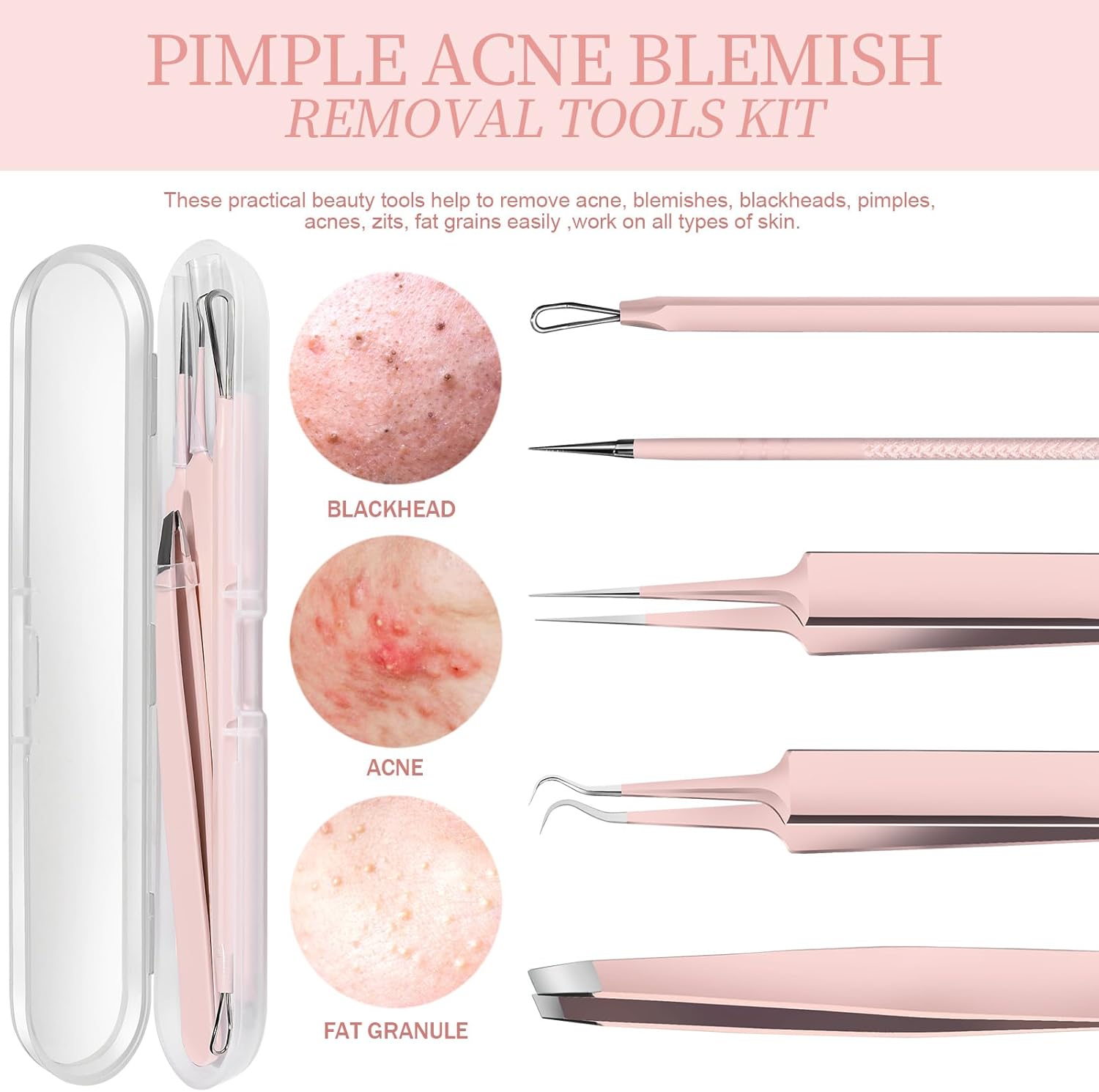 Blackhead & Pore Extractor Tool Set
