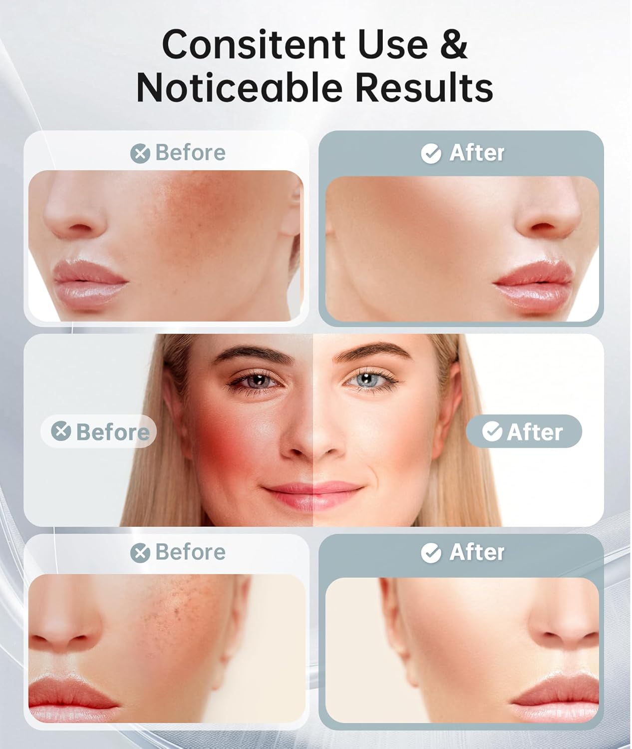 Thermal Vibrating Face Massager