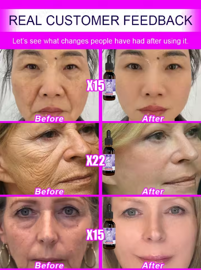 Restore your skin in just a few days, without doctors, without spending a lot of money and without pain